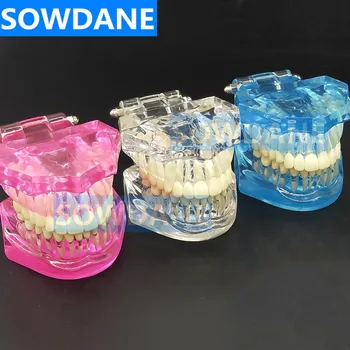 Стандартная стоматологическая модель зубов, Ортодонтическая модель для общения с пациентом, Стоматологический кабинет, клиника, модель инструмента, Несъемные зубы